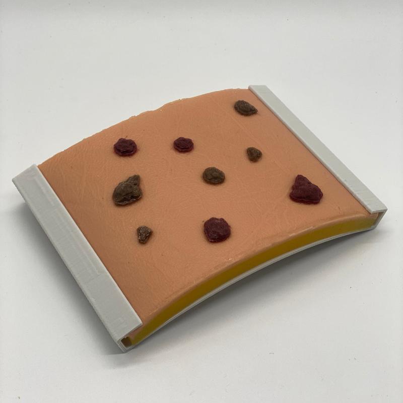 Biopsy practice pad - 3 layer with 9 lesions - Medimodels