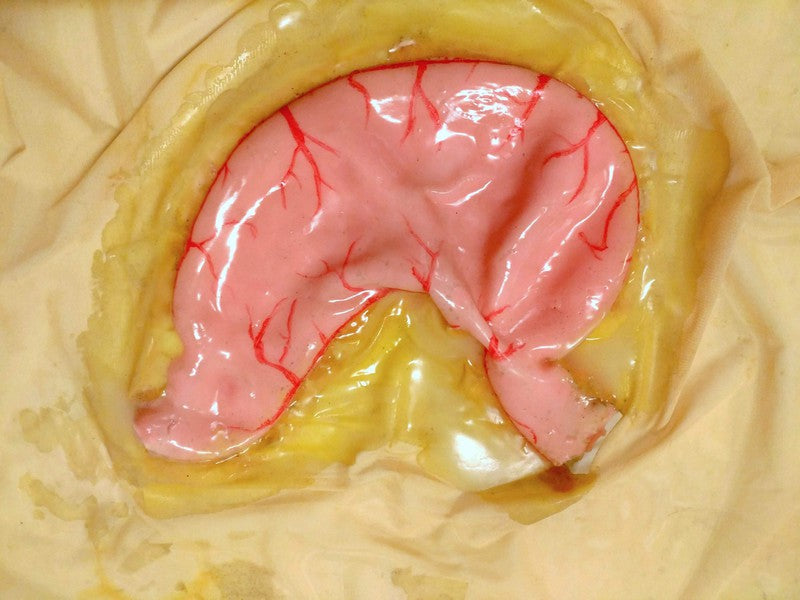 Stomach simulator for Gastroplasty - Medimodels