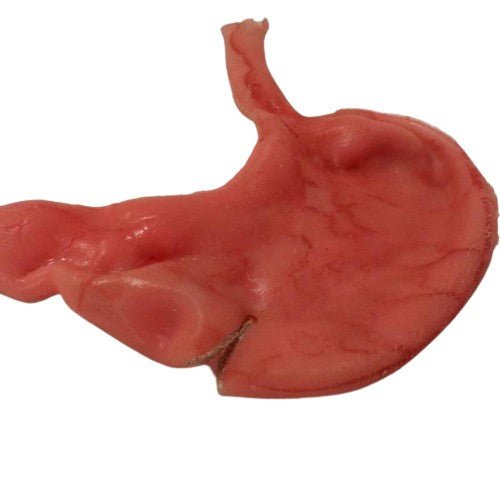 Stomach simulator for Gastroplasty - Medimodels